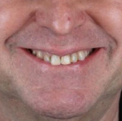 estetica-sorriso-homem-antes-do-procedimento-unique654