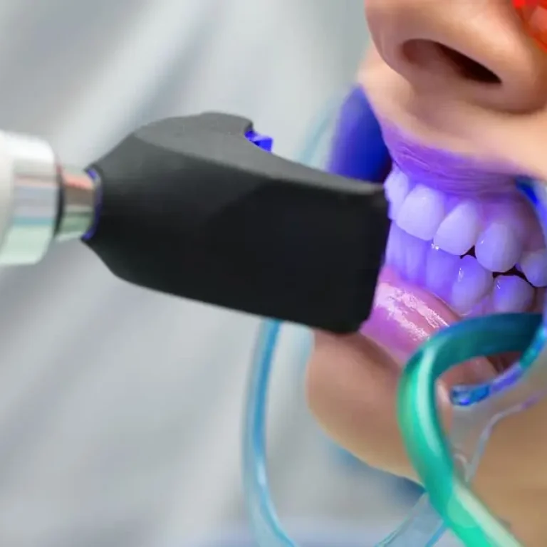clareamento-dental-dentista-unique-recife