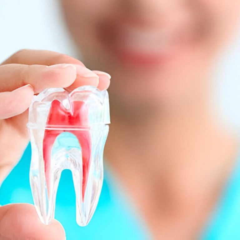 Tratamento de canal em Recife na Unique Odontologia